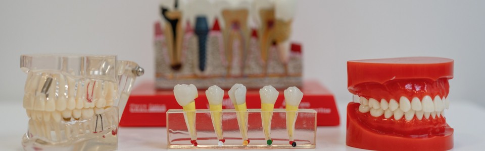 Orthodontiste Amiens Dr LAura Wanglin traitement racines